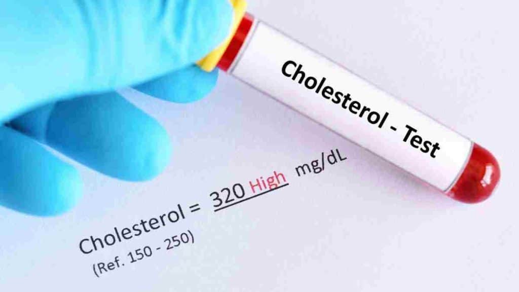 conseils-pour-prevenir-lhypercholesterolemie-et-eviter-les-complications-et-les-problemes-graves