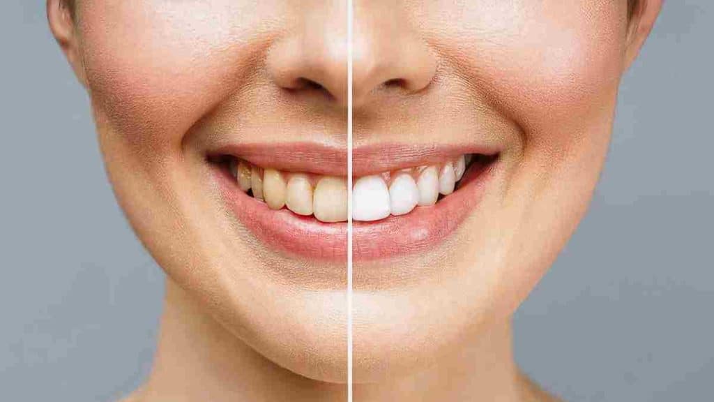 aliments-pouvant-entacher-et-jaunir-les-dents-quil-vaudrait-mieux-minimiser-pour-avoir-un-beau-sourire